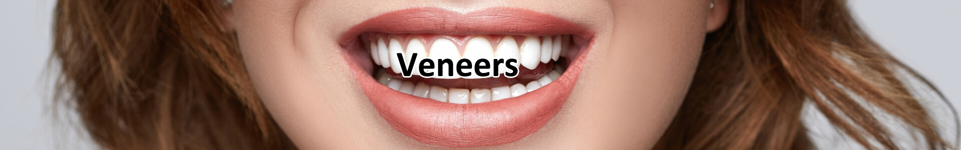 Best Veneers Services Visalia 